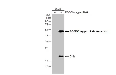 Anti-Shh antibody [HL2076] used in Western Blot (WB). GTX637984