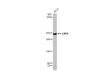 Anti-LRP4 antibody [HL2080] used in Western Blot (WB). GTX637988