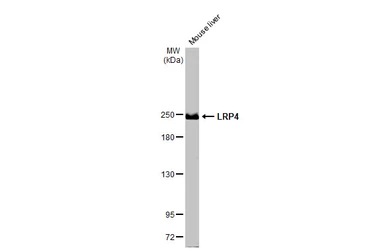 Anti-LRP4 antibody [HL2080] used in Western Blot (WB). GTX637988