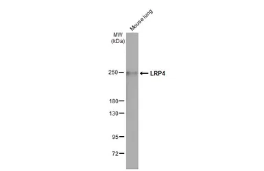 Anti-LRP4 antibody [HL2080] used in Western Blot (WB). GTX637988