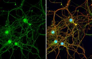 Anti-LRP4 antibody [HL2080] used in Immunocytochemistry/ Immunofluorescence (ICC/IF). GTX637988