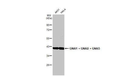 Anti-GNAI1 + GNAI2 + GNAI3 antibody [HL2092] used in Western Blot (WB). GTX638000