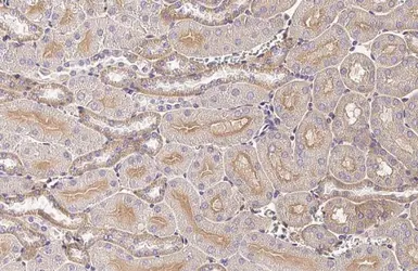 Anti-GNAI1 + GNAI2 + GNAI3 antibody [HL2092] used in IHC (Paraffin sections) (IHC-P). GTX638000
