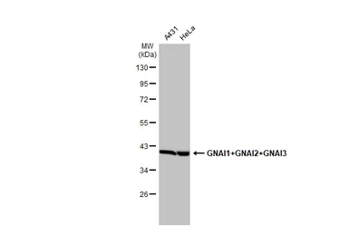 Anti-GNAI1 + GNAI2 + GNAI3 antibody [HL2093] used in Western Blot (WB). GTX638001