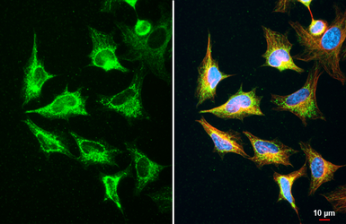Anti-GNAI1 + GNAI2 + GNAI3 antibody [HL2093] used in Immunocytochemistry/ Immunofluorescence (ICC/IF). GTX638001