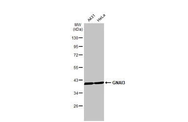 Anti-GNAI3 antibody [HL2096] used in Western Blot (WB). GTX638004