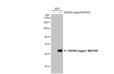 Anti-MAP3K8 antibody [HL2118] used in Western Blot (WB). GTX638090