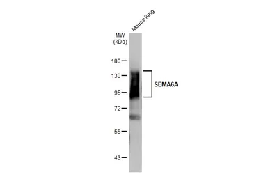 Anti-SEMA6A antibody [HL2120] used in Western Blot (WB). GTX638092