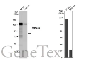 Anti-SEMA6A antibody [HL2120] used in Western Blot (WB). GTX638092