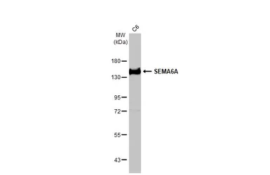 Anti-SEMA6A antibody [HL2120] used in Western Blot (WB). GTX638092