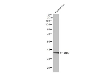 Anti-OTC antibody [HL2122] used in Western Blot (WB). GTX638094