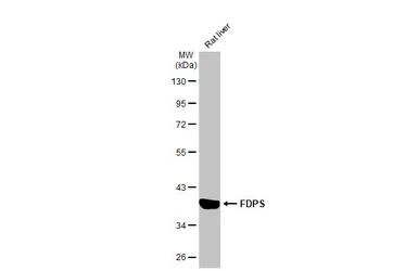 Anti-FDPS antibody [HL2123] used in Western Blot (WB). GTX638095
