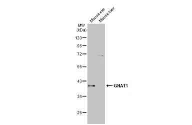 Anti-GNAT1 antibody [HL2126] used in Western Blot (WB). GTX638098