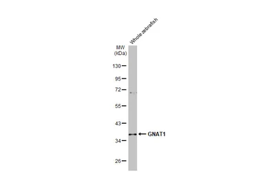 Anti-GNAT1 antibody [HL2126] used in Western Blot (WB). GTX638098