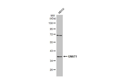 Anti-GNAT1 antibody [HL2126] used in Western Blot (WB). GTX638098