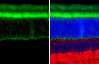 Anti-GNAT1 antibody [HL2126] used in IHC (Paraffin sections) (IHC-P). GTX638098