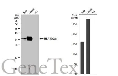 Anti-HLA-DQA1 antibody [HL2139] used in Western Blot (WB). GTX638111