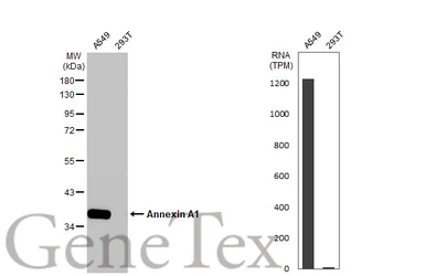 Anti-Annexin A1 antibody [HL2142] used in Western Blot (WB). GTX638120