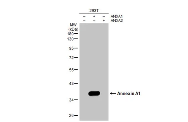Anti-Annexin A1 antibody [HL2142] used in Western Blot (WB). GTX638120