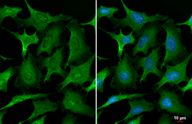 Anti-Annexin A1 antibody [HL2142] used in Immunocytochemistry/ Immunofluorescence (ICC/IF). GTX638120