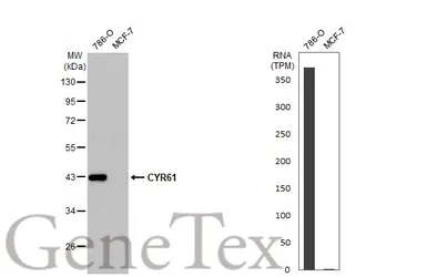 Anti-CYR61 antibody [HL2144] used in Western Blot (WB). GTX638122