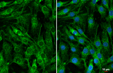 Anti-CYR61 antibody [HL2144] used in Immunocytochemistry/ Immunofluorescence (ICC/IF). GTX638122