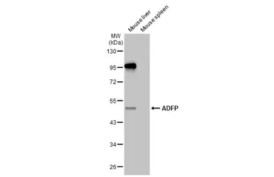 Anti-ADFP antibody [HL2147] used in Western Blot (WB). GTX638125