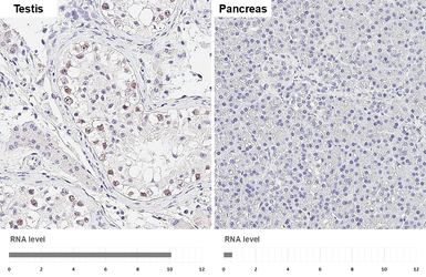 Anti-POLE antibody [HL2150] used in IHC (Paraffin sections) (IHC-P). GTX638128
