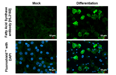 Anti-Fatty Acid Synthase antibody [HL2160] used in Immunocytochemistry/ Immunofluorescence (ICC/IF). GTX638138