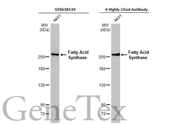 Anti-Fatty Acid Synthase antibody [HL2161] used in Western Blot (WB). GTX638139