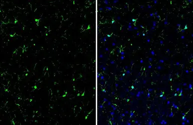 Anti-Iba1 antibody [HL1880-MS] used in IHC (Paraffin sections) (IHC-P). GTX638147