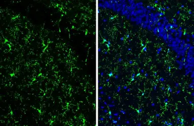 Anti-Iba1 antibody [HL1880-MS] used in IHC (Frozen sections) (IHC-Fr). GTX638147