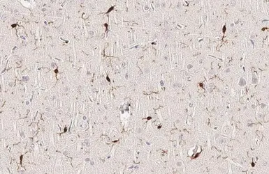 Anti-Iba1 antibody [HL1880-RT] used in IHC (Paraffin sections) (IHC-P). GTX638148