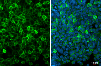 Anti-Iba1 antibody [HL1880-RT] used in Immunocytochemistry/ Immunofluorescence (ICC/IF). GTX638148