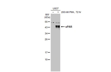 Anti-uPAR antibody [HL2169] used in Western Blot (WB). GTX638173