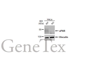 Anti-uPAR antibody [HL2169] used in Western Blot (WB). GTX638173