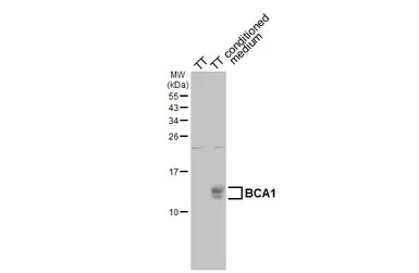 Anti-BCA1 antibody [HL2172] used in Western Blot (WB). GTX638176