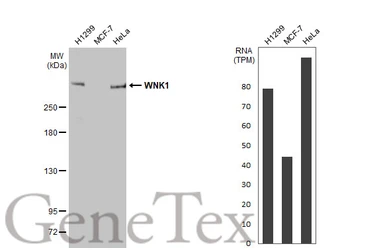Anti-WNK1 antibody [HL2184] used in Western Blot (WB). GTX638188