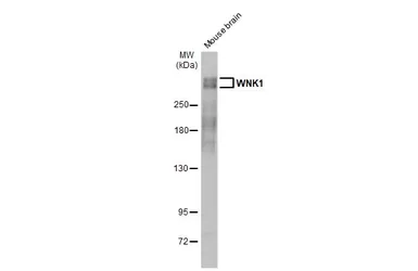 Anti-WNK1 antibody [HL2184] used in Western Blot (WB). GTX638188