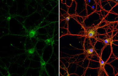 Anti-WNK1 antibody [HL2184] used in Immunocytochemistry/ Immunofluorescence (ICC/IF). GTX638188