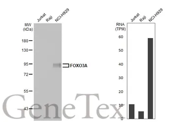 Anti-FOXO3A antibody [HL2190] used in Western Blot (WB). GTX638194