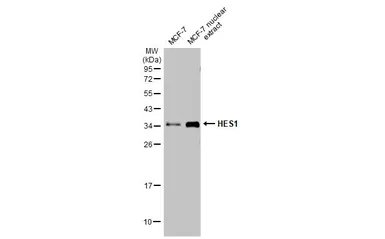 Anti-HES1 antibody [HL2198] used in Western Blot (WB). GTX638202
