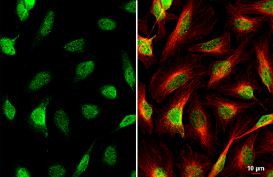 Anti-HES1 antibody [HL2198] used in Immunocytochemistry/ Immunofluorescence (ICC/IF). GTX638202