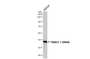 Anti-GNA11 + GNAQ antibody [HL2203] used in Western Blot (WB). GTX638207