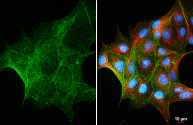 Anti-GNA11 + GNAQ antibody [HL2203] used in Immunocytochemistry/ Immunofluorescence (ICC/IF). GTX638207