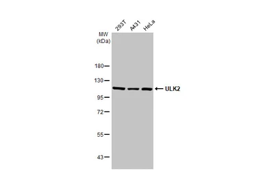 Anti-ULK2 antibody [HL2206] used in Western Blot (WB). GTX638210