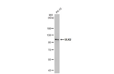 Anti-ULK2 antibody [HL2206] used in Western Blot (WB). GTX638210