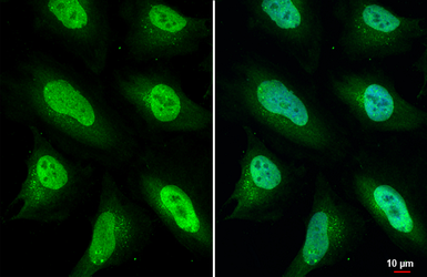 Anti-ULK2 antibody [HL2206] used in Immunocytochemistry/ Immunofluorescence (ICC/IF). GTX638210