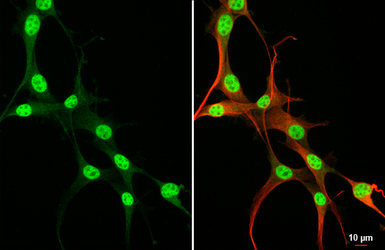 Anti-RUNX1 antibody [HL2211] used in Immunocytochemistry/ Immunofluorescence (ICC/IF). GTX638215