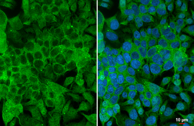 Anti-Angiogenin antibody [HL2215] used in Immunocytochemistry/ Immunofluorescence (ICC/IF). GTX638219